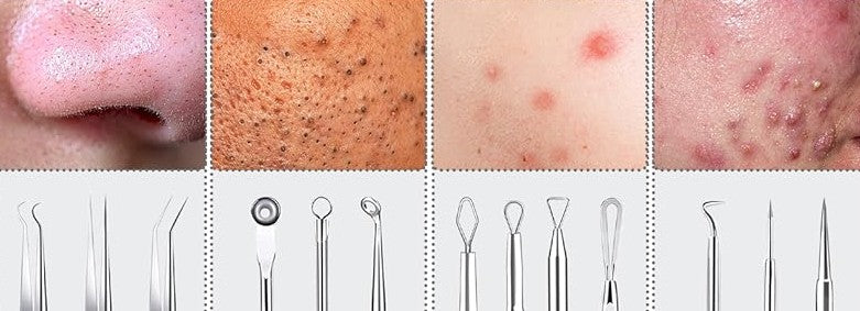 Blackhead Remover Tools, 16 PCS Pimple Popper Tool Kit, Acne Blackhead Tools for Blemish, 410 Premium Professional Stainless Acne Pimple Extractor Tool with Metal Box